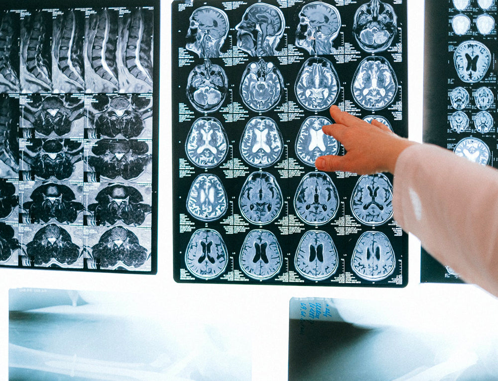 The Gut Brain Connection and Your Gut-Brain Axis